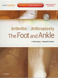 Arthitis & arthroplasty : the foot and ankle