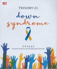 Trisomy-21 down syndrome